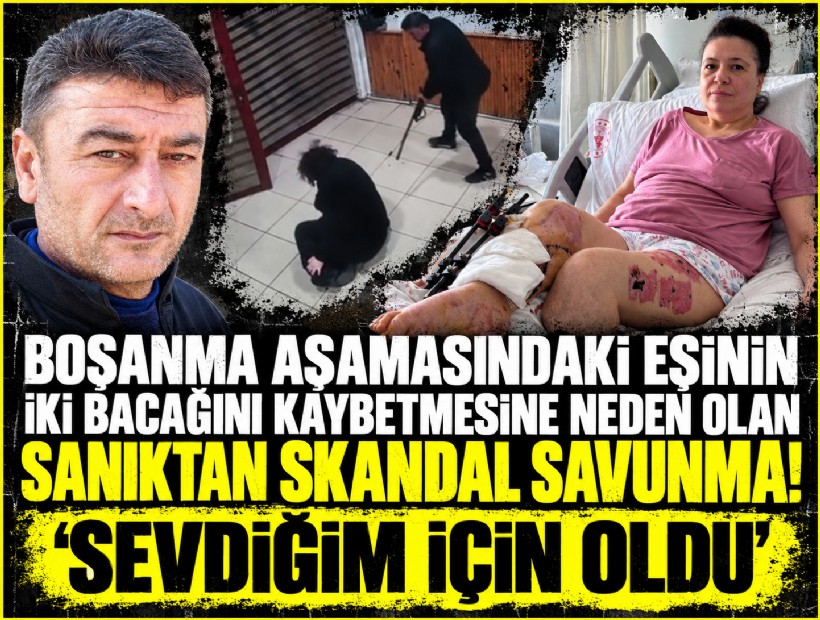 Boşanma aşamasındaki eşinin iki bacağını kaybetmesine neden olan sanıktan skandal savunma! 'Sevdiğim için oldu'