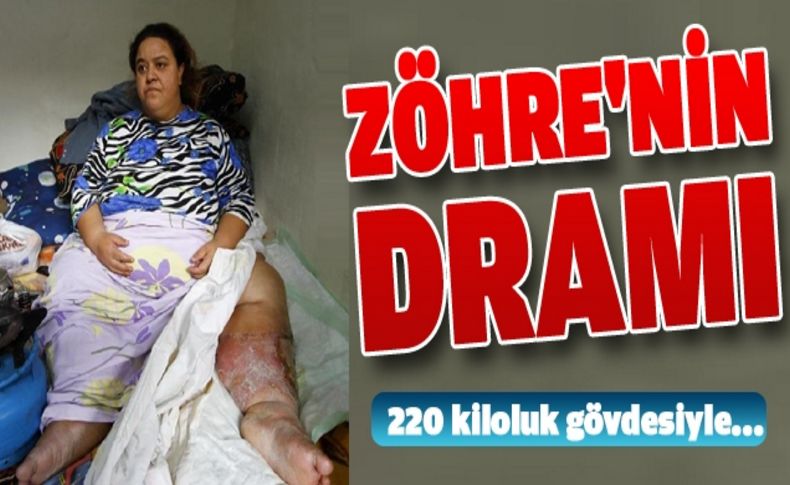 220 kiloluk Zöhre Gezek tedavi olmak istiyor