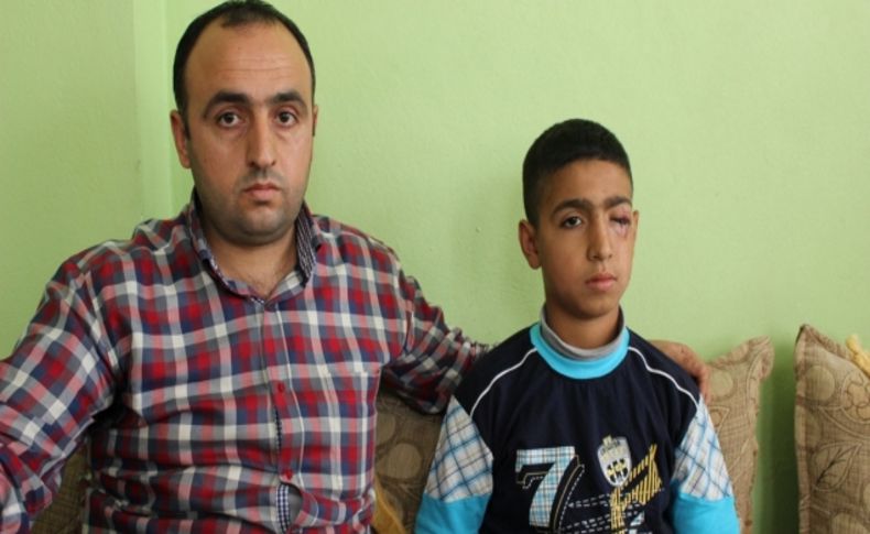 Atılan maytap, 12 yaşındaki çocuğun gözüne isabet etti